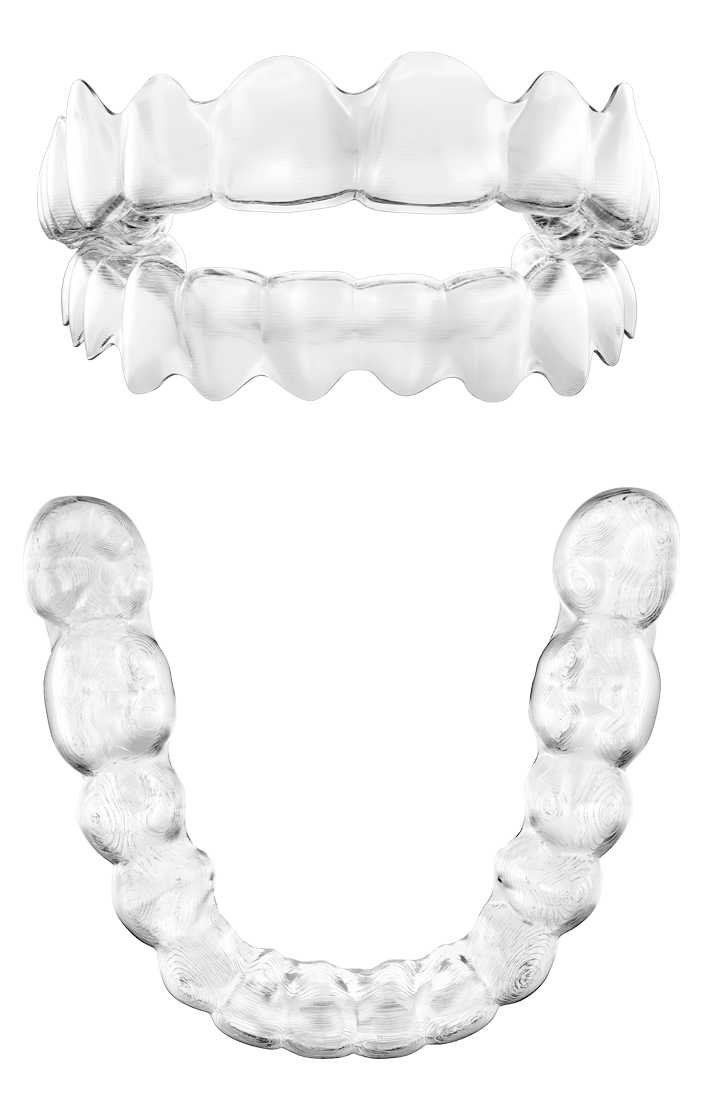 invisalign braces